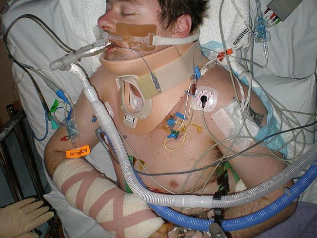 David Cook in hospital after his accident.