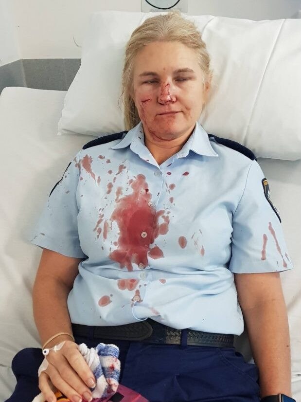 Sergeant Rachael Robins after she was assaulted by Aaron Heather.