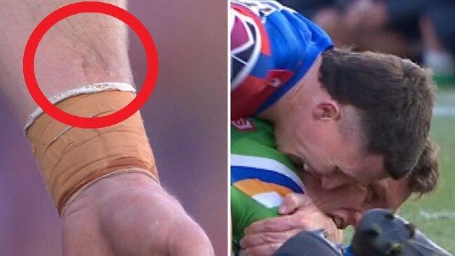 The mark on Gamble’s arm (left) and the moment in question with Wighton on the right.