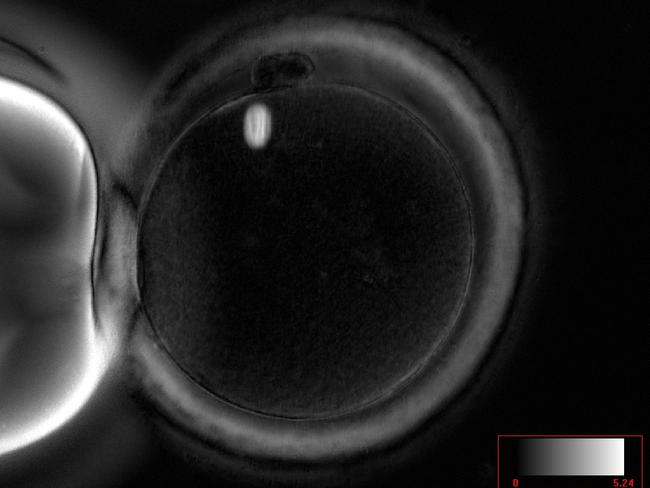 A mature egg; the white structure inside the egg is the metaphase II meiotic spindle. An example of a normal spindle. Picture: IVF Australia