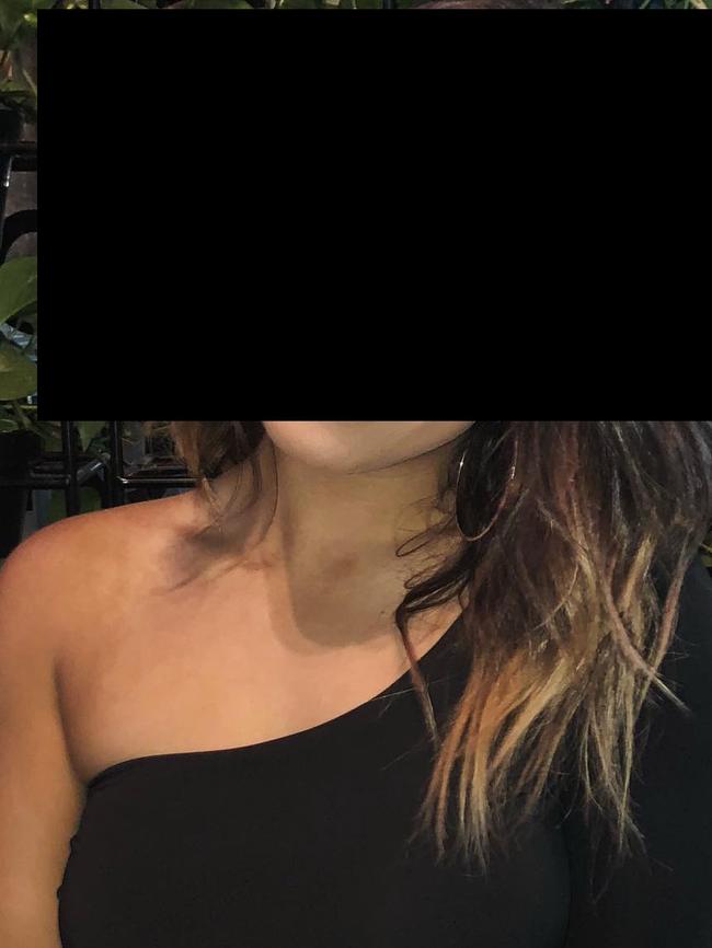 The woman, who cannot be identified for legal reasons, was allegedly stabbed at random while jogging.