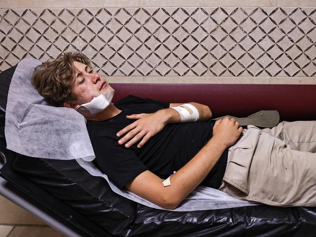 A foreign volunteer receives treatment at Nablus's Rafidia Hospital, after they were attacked by Israeli settlers while helping Palestinian farmers in Qusra village in the occupied West Bank. Picture: AFP