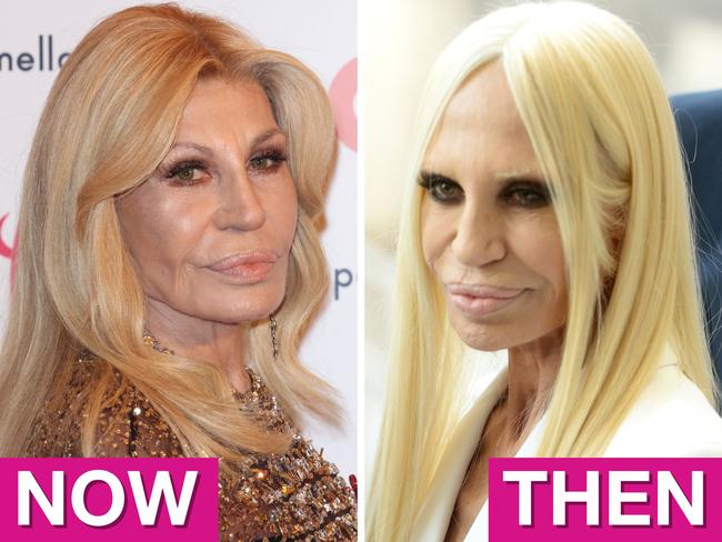 Donatella Versace's new face pics. Picture: Getty Images