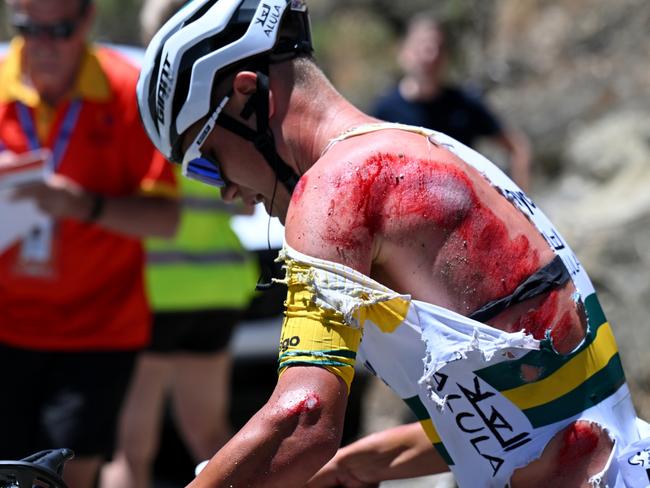 CAMPBELLTOWN, AUSTRALIA - JANUARY 18: (EDITORS NOTE: Image depicts graphic content.) Luke Plapp of Australia and Team Jayco AlUla injury after being involved in a crash during the 24th Santos Tour Down Under 2024, Stage 3 a 145.3km stage from Tea Tree Gully to Campbelltown / #UCIWT / on January 18, 2024 in Campbelltown, Australia. (Photo by Tim de Waele/Getty Images)