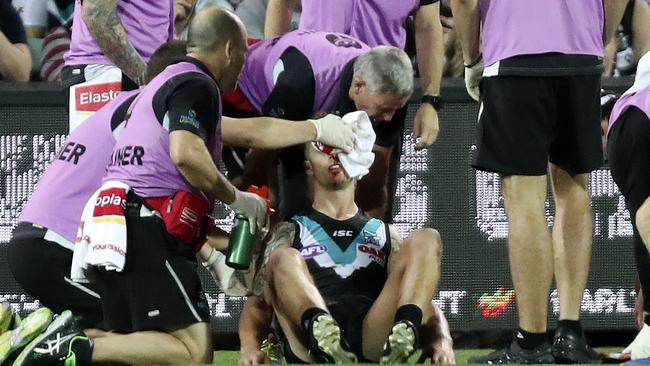 Hamish Hartlett was stretchered off after a brutal head clash with Patrick Dangerfield but later returned. Picture: Sarah Reed