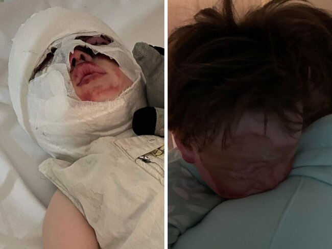 A family was enjoyed a routine night by the bonfire on their rural property last week when tragedy struck, leaving two boys with catastrophic injuries.