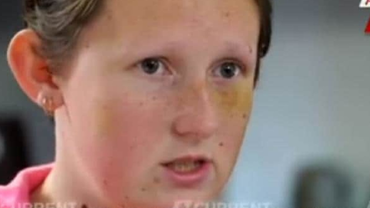 Kayla Kendrigan spoke to A Current Affair about her ordeal. Picture: ACA