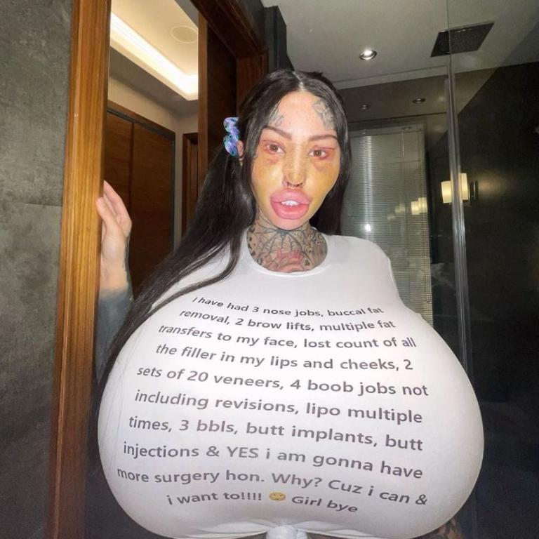 Influencer shows off latest 'barbie nose' and 'cat eyes' | Photos