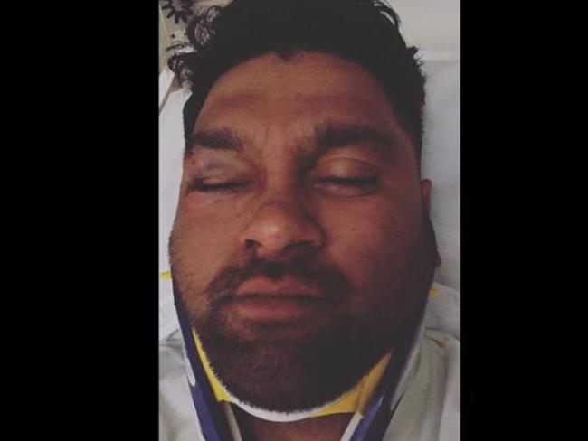 Melbourne Rebels players Hunter Paisami and Pone Faamausili have been stood down after allegedly assaulting this man, his sister has claimed on Facebook. Picture: Facebook/Lucy Annabell Yakapo