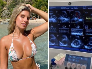 Aussie model opens up about health struggle