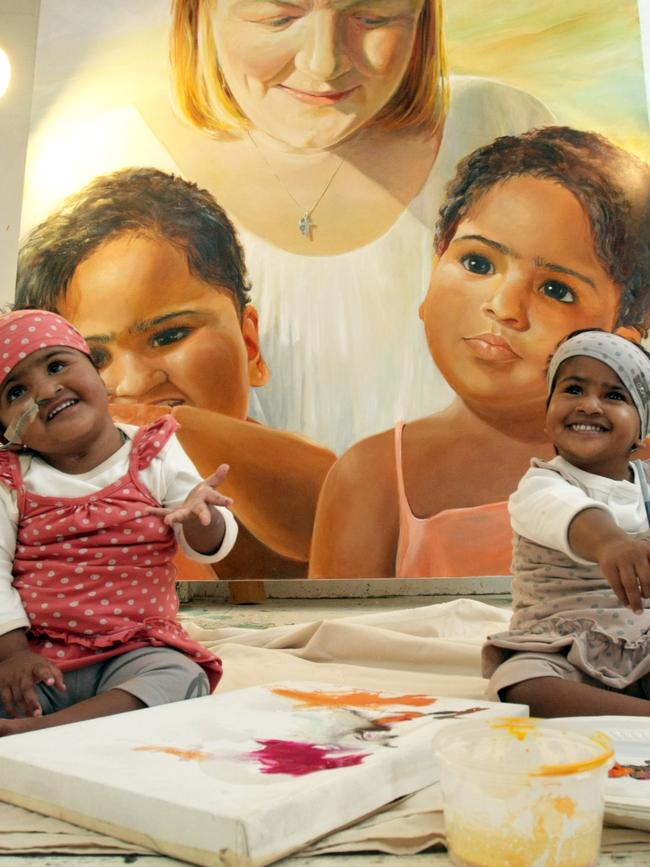 Krishna (left) and Trishna (right) were saved at the same hospital.