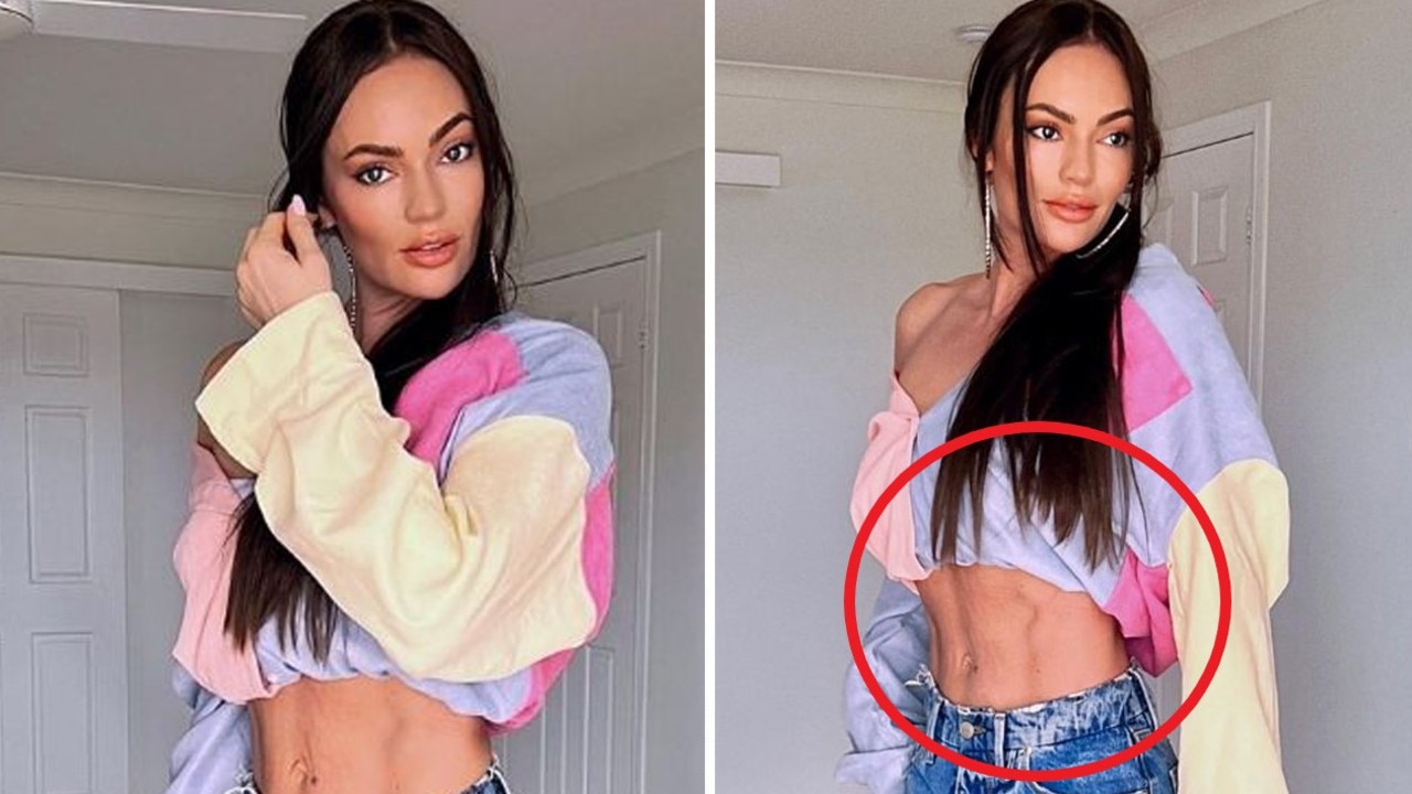 Loose skin in fitness influencer Emily Skye's photo applauded
