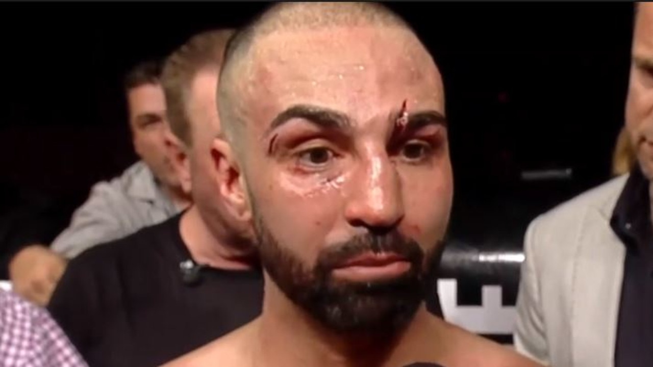 Paulie Malignaggi loses on bare knuckle boxing debut.