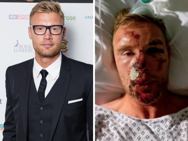 Andrew Flintoff before and after his injuries. Photos: Getty Images/Supplied