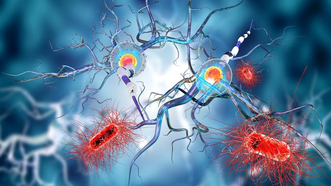 3d illustration of nerve cells, concept for Neurological Diseases, tumors and brain surgery.