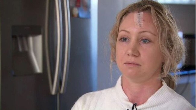 Sydney nurse Bec Davies, 31, was allegedly attacked by a patient in Westmead Hospital. Picture: Nine News