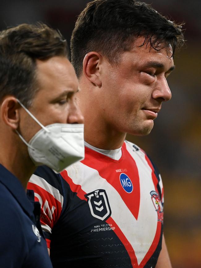 Joseph Manu taken off with facial fractures. Picture: NRL Photos