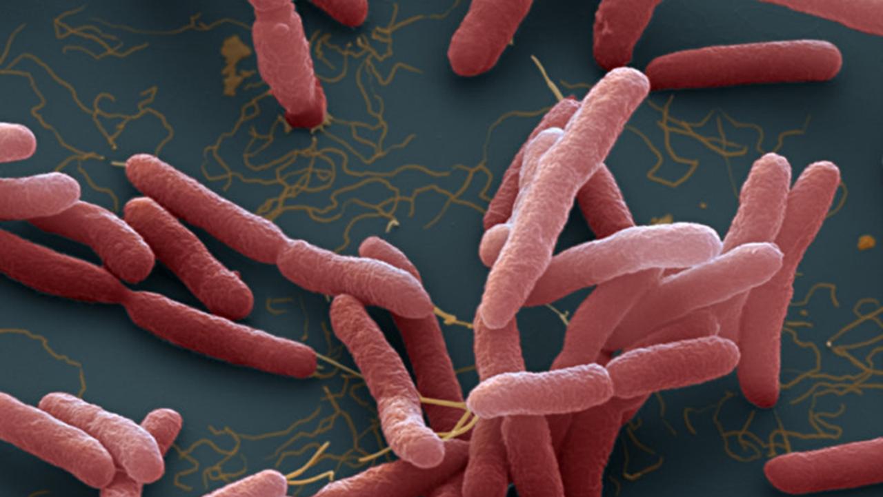 Burkholderia pseudomallei. A bacteria which cause melioidosis, a disease spread through contaminated water and soil.