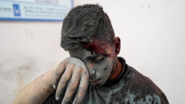 A Palestinian boy is severely injured after Israel attacked Nuseirat refugee camp. Picture: AFP