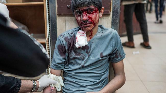 An injured youth gets firt aid at the Al-Aqsa Martyrs Hospital in Deir al-Balah, central Gaza Strip, on Tuesday. Picture: AFP