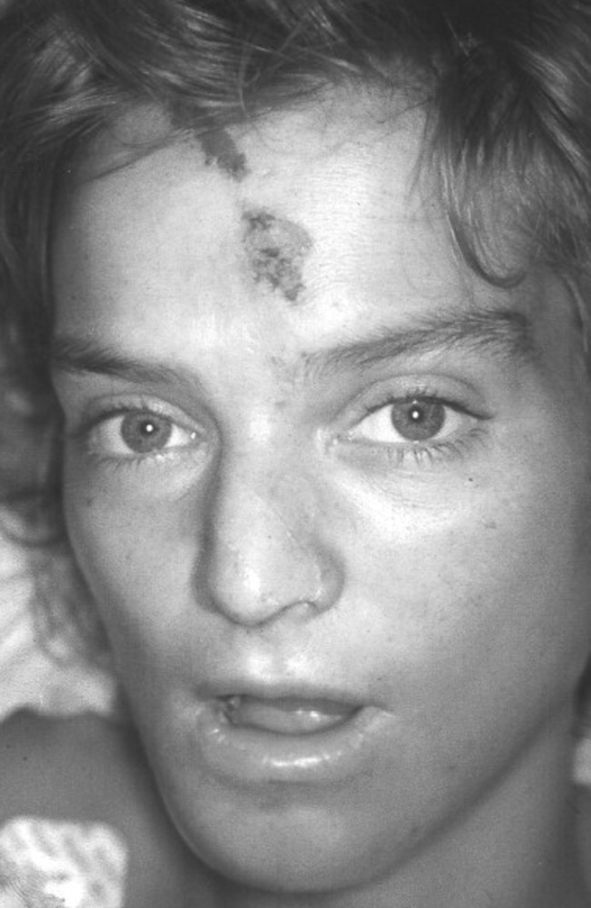 Sole plane crash survivor Annette Herfkens in Singapore in 1992. Picture: Provided by publisher