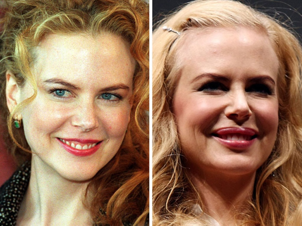 Nicole Kidman once admitted, ‘I did try Botox, unfortunately, but I got out of it and now I can finally move my face again.’ Picture: Getty Images