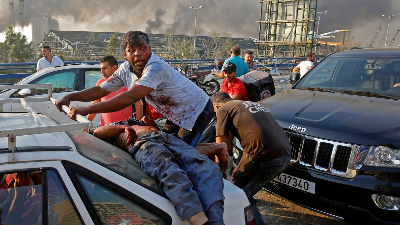 An injured man lies at the back of a car before being rushed away from the scene. Picture: AFP