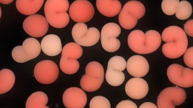 Zygotes undergoing first cell division following in vitro fertilisation at the Coral Spawning Lab in Sevenoaks, Kent. Picture: Jamie Craggs