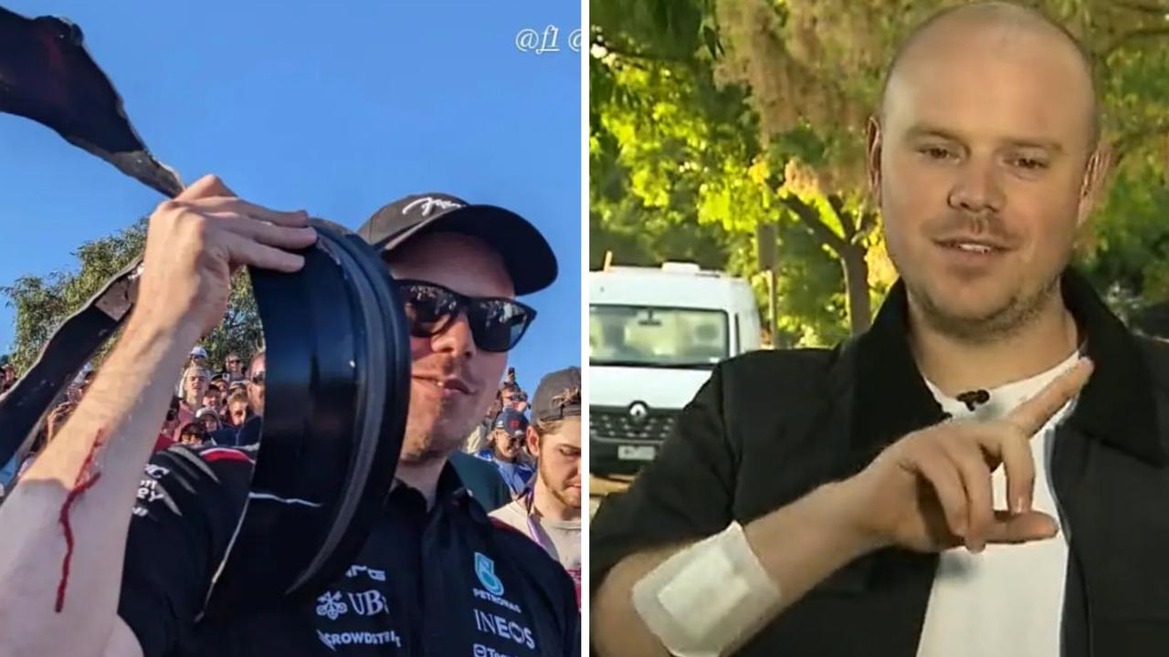 F1 fan Will Street holding the piece of metal that cut his arm (Instagram) and speaking to Sunrise (Channel 7).