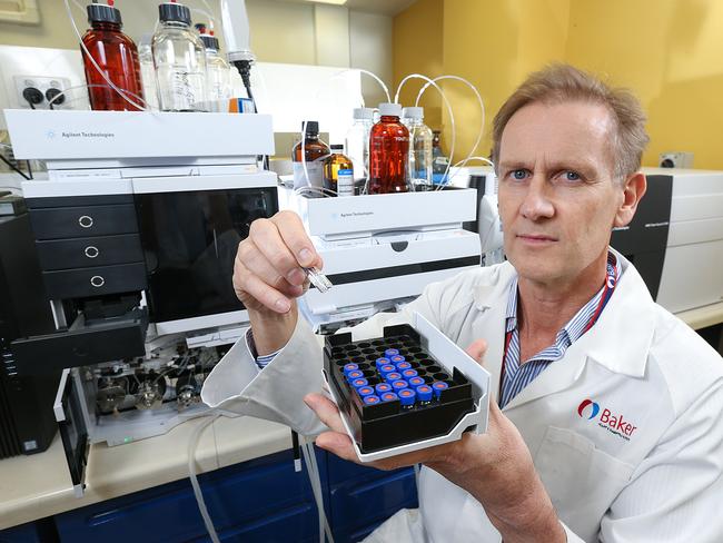 The Baker Heart and Diabetes Institute’s Professor Peter Meikle. Picture: Ian Currie