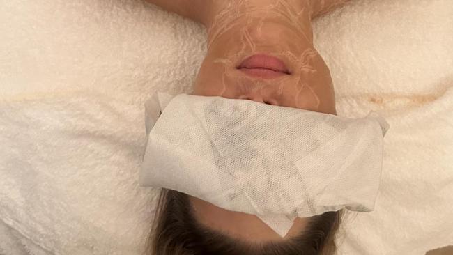 ‘I just tried this celebrity trend – I can’t move my face’