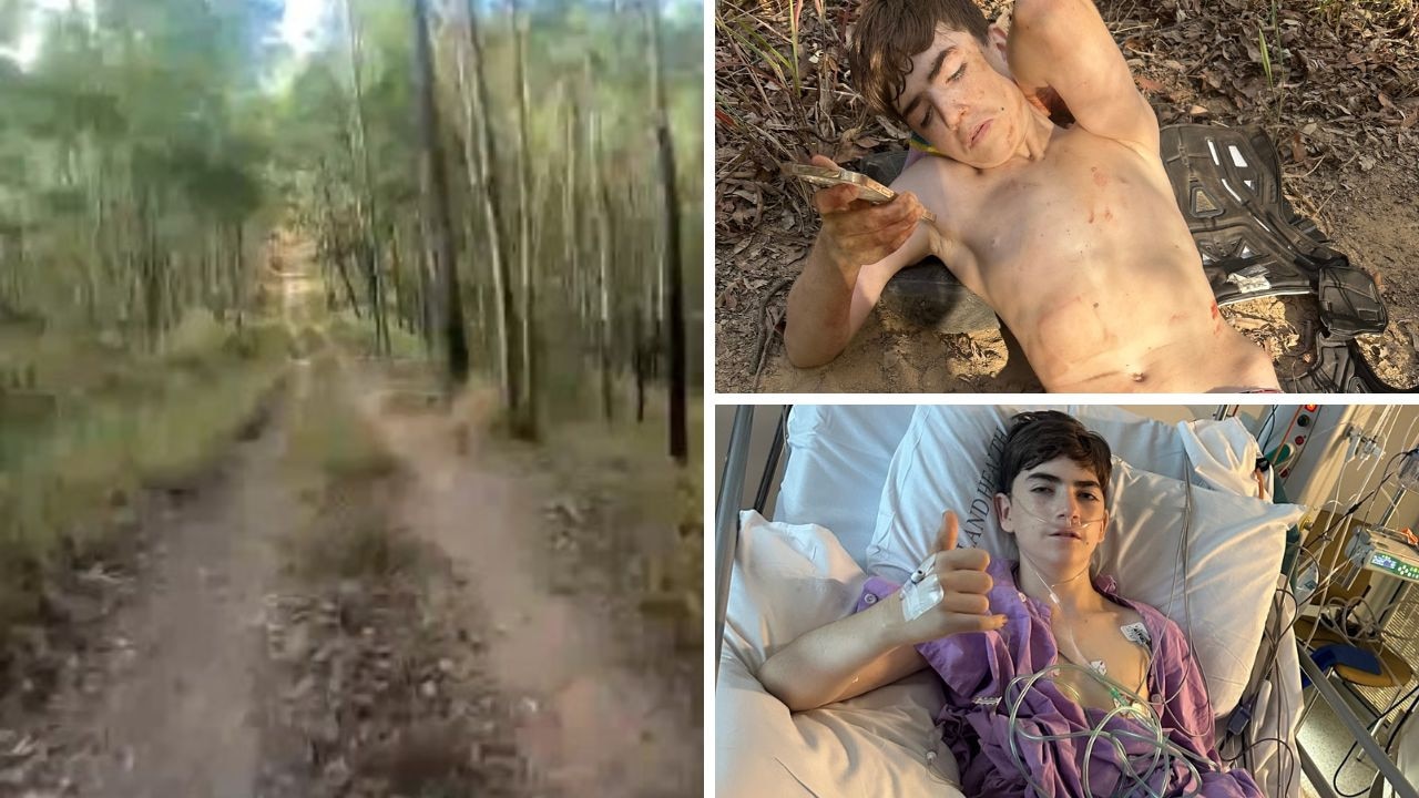 Teen trail bike rider uses Siri to survive horror injuries
