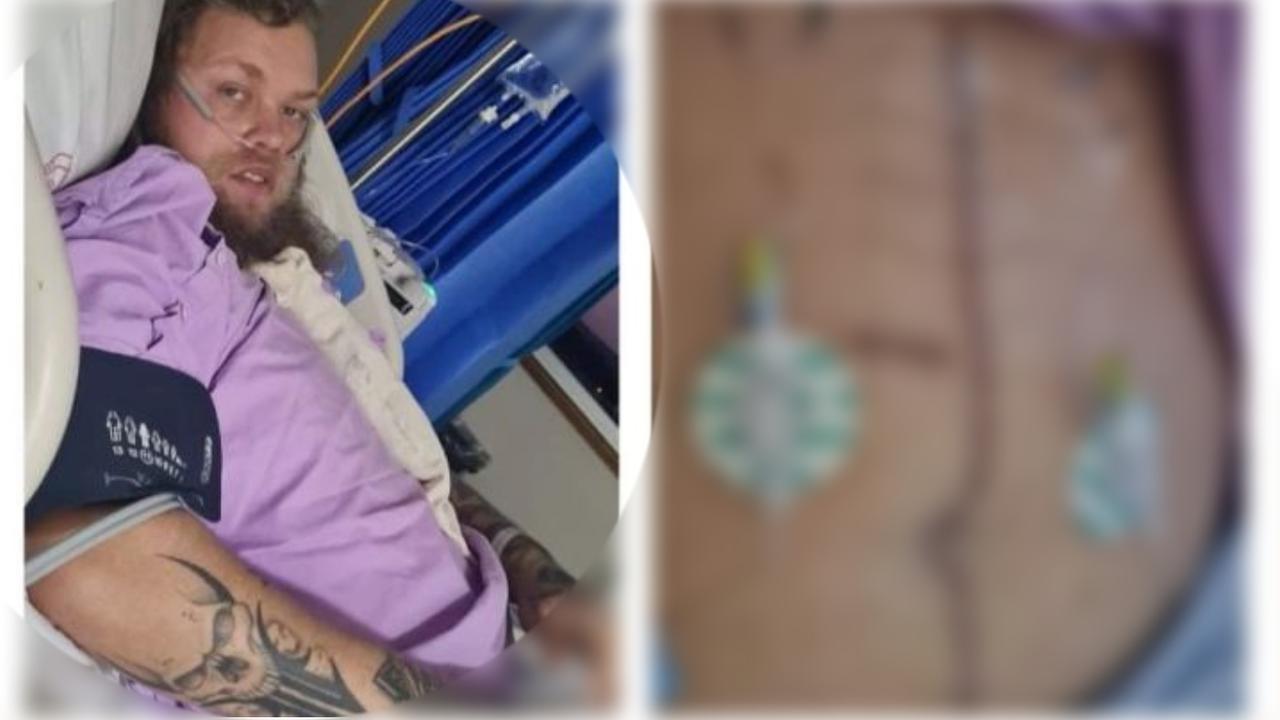 FINANCIAL SUPPORT: A GoFundMe has been launched for the victim of a stabbing incident at a Toowoomba service station late last month. The Dalby man, Bodi Mcdonald received an eight centimetre deep knife wound in his abdomen as well as a 40 centimetre gash on his stomach after doctors had to determine the extent of the damage made to his internal organs. Pictures: Contributed