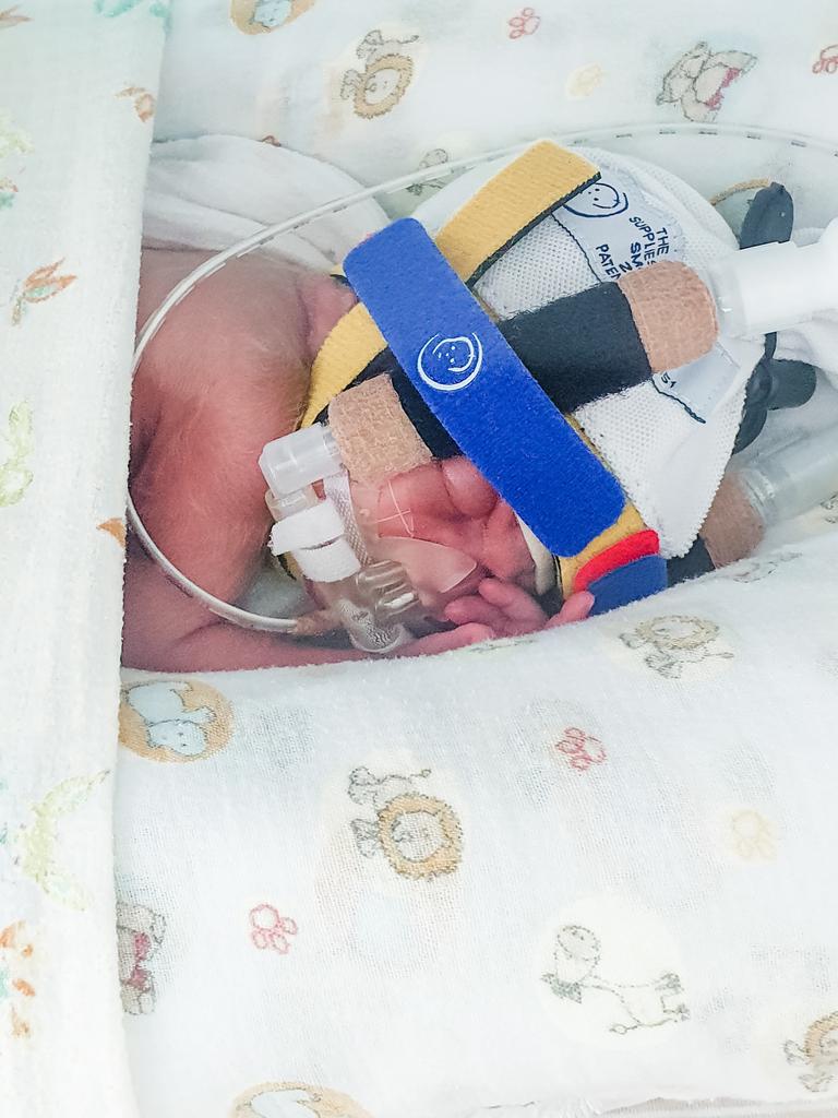 William (972g) was admitted to the neonatal intensive care unit (NICU). Picture: Supplied.