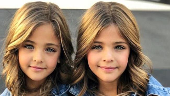 An image of the Most beautiful twins in the world