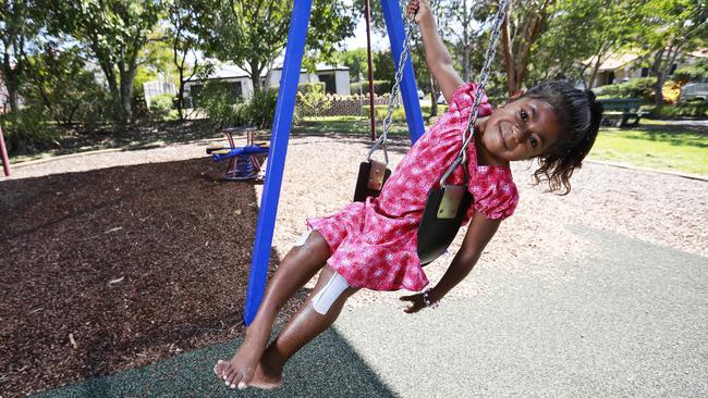 Bindisa Powaseu, 10, of Papua New Guinea was born with a rare kidney disease that affected her bone development. But she’s had surgery at the Queensland Children’s Hospital that hopefully will cause her legs to straighten over time. Picture: Claudia Baxter.