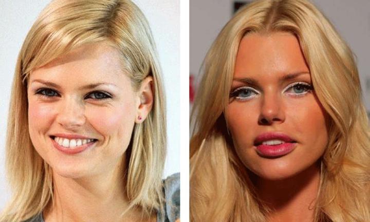 Sophie Monk looks so different after surgery.