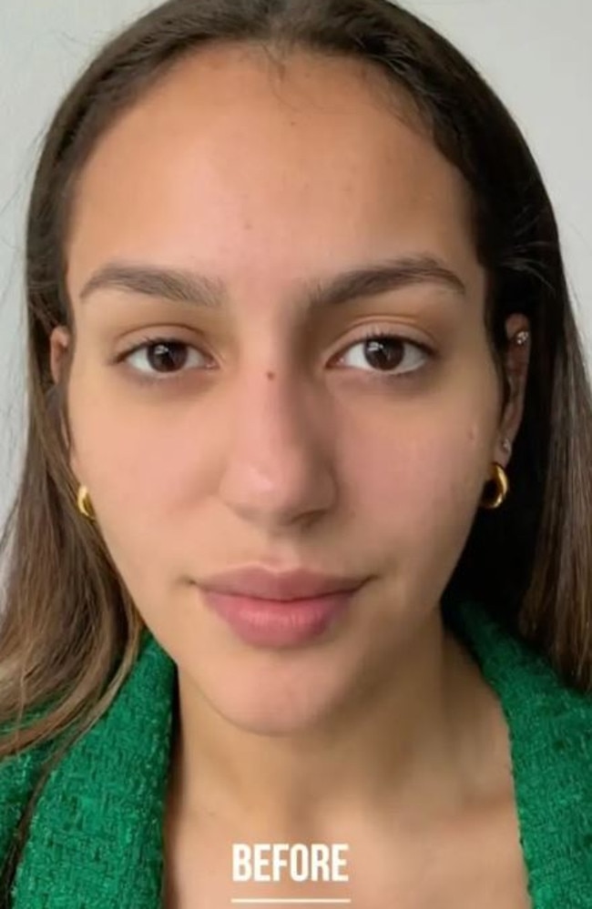 Experts have warned against an iris colour-changing procedure going viral on social media, saying it can result in blindness. Picture: TikTok