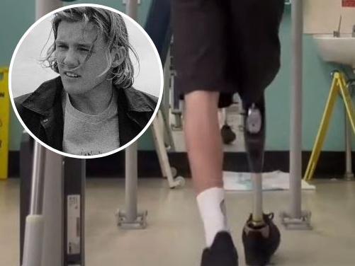 Mid-North Coast shark attack victim Kai McKenzie testing out his new artificial leg.