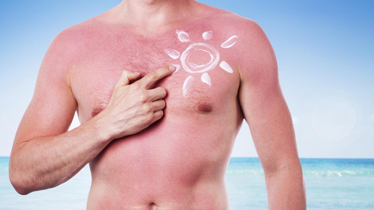 Melanoma in Victoria: men more likely to die | Herald Sun