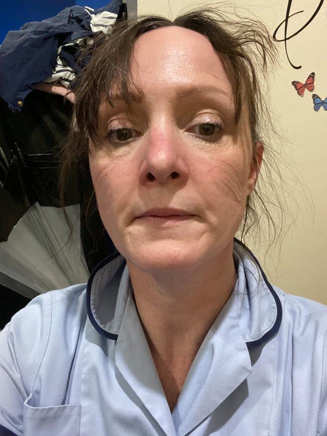 NHS workers have been hailed as heroes as they shared what they look like at the end of an exhausting shift battling coronavirus. Picture: Twitter