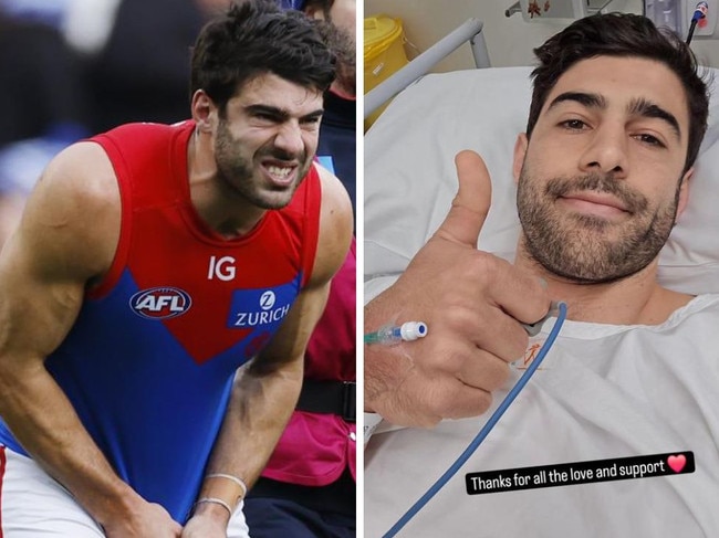 AFL star can’t watch footy after horror injury