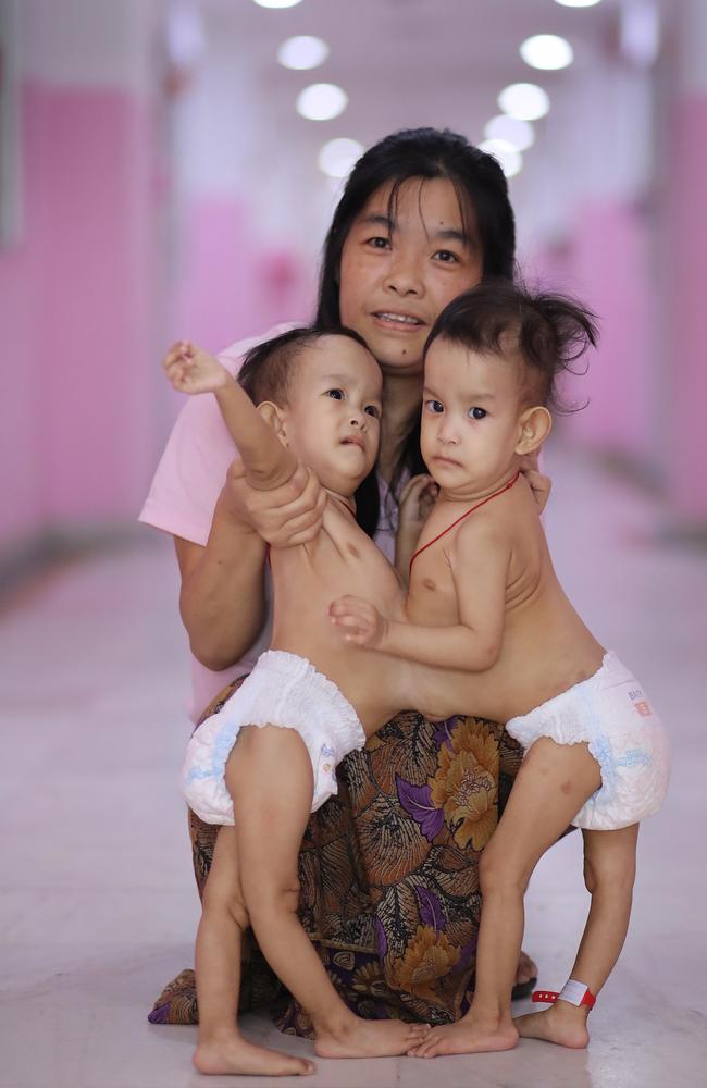 Nima and Dawa in a Bhutan hospital before being flown to Australia. Picture: Alex Coppel