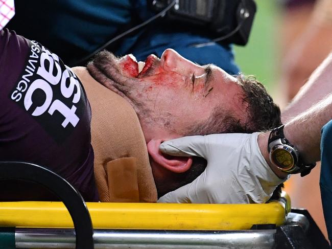 Corey Oates of the Broncos is treated by medical staff after being injured during the NRL Semi-Final match between the Brisbane Broncos and the Penrith Panthers at Suncorp Stadium in Brisbane, Friday, September 15, 2017. (AAP Image/Darren England) NO ARCHIVING