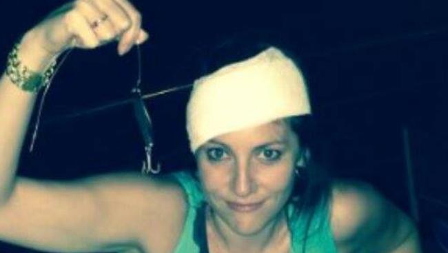 Helen Bull was struck in the head by a rouge fishing lure while dining on the deck at The Jetty.