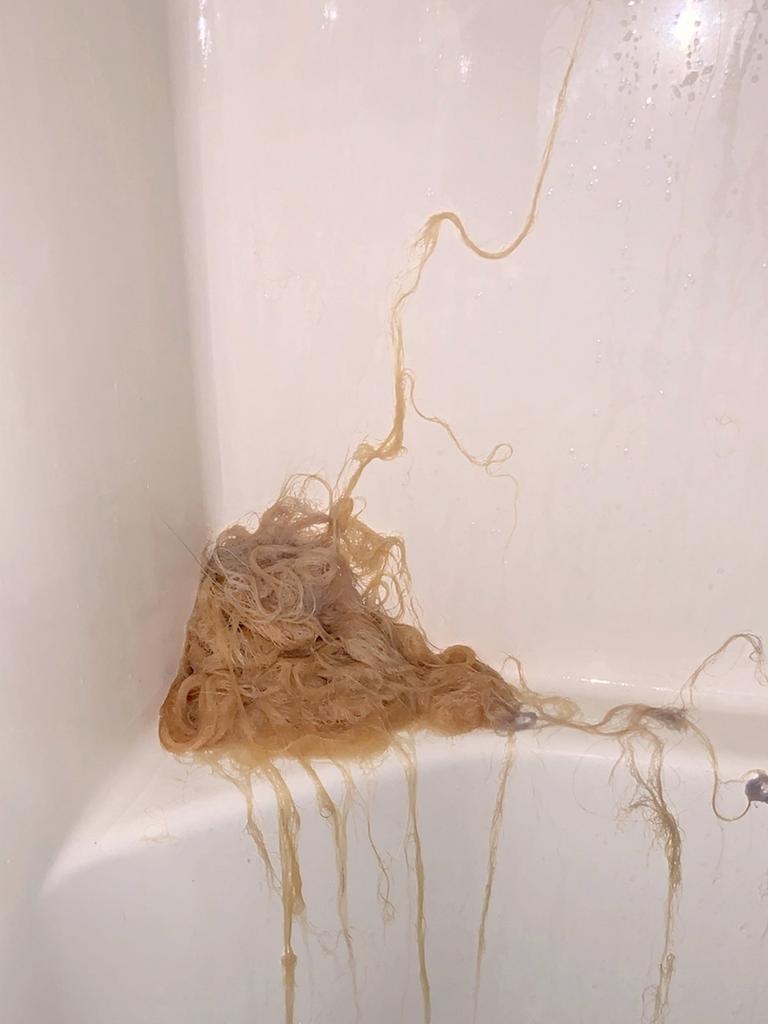 So much hair fell out, she said it looked like there was a pile of noodles in her shower. Picture: Caters News 