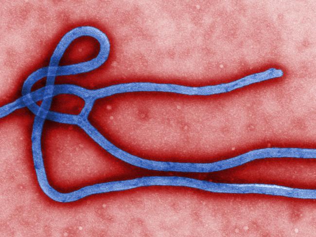 FILE - This undated file image made available by the Centers for Disease Control (CDC) shows the Ebola virus. A Texas health care worker who provided hospital care for Thomas Eric Duncan, who later died has tested positive for the virus, health officials said Sunday Oct. 12, 2014. Dr. David Varga, of the Texas Health Resource, says the worker was in full protective gear when they provided care to Duncan during his second visit to Texas Health Presbyterian Hospital. (AP Photo/Centers for Disease Control, File)