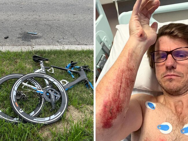 ‘I just knew it was all over’: Cyclist’s pain after accident