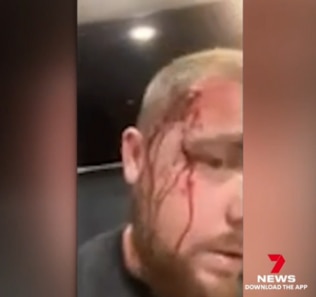 A large gash on the side of his head is one of the gruesome injuries. Picture: Channel 7/ Seven News