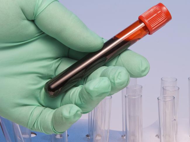 A scientist handling a blood sample in a test tube.Picture: istock